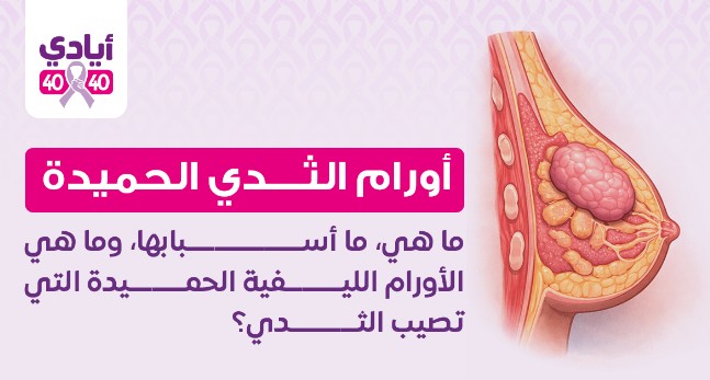 Benign Breast Tumors